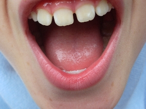 mouth mouth